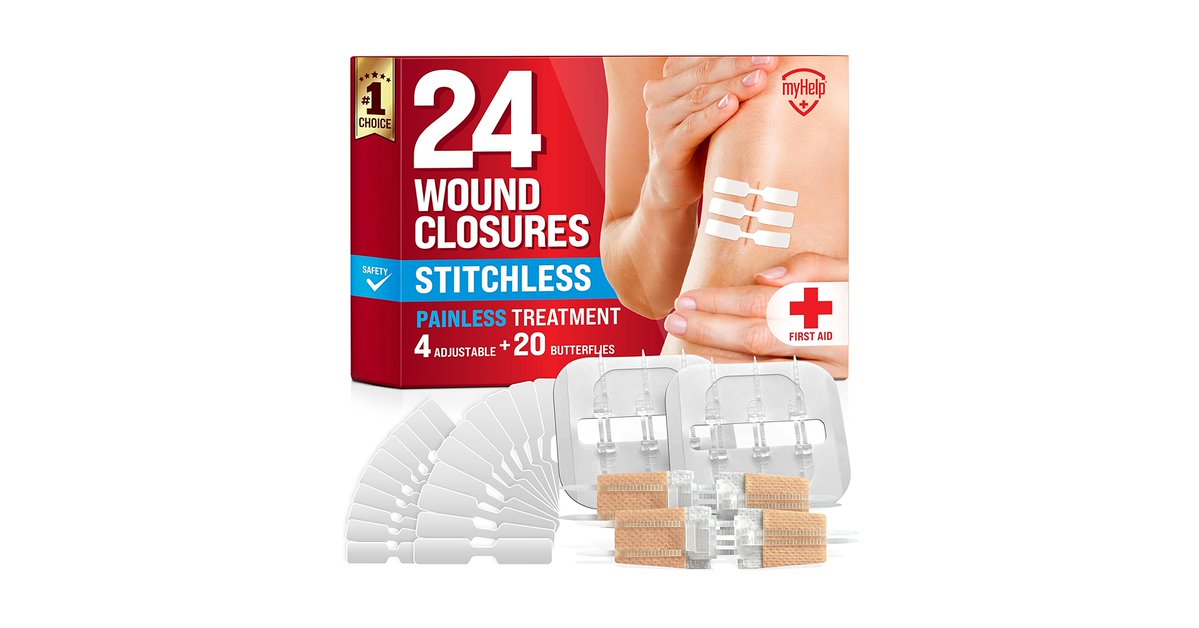 Quick Review: MyHelp Emergency Wound Closure Strips – Skip the Doctor’s Visit for Minor Cuts
